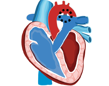 disease-condtions-pda.png