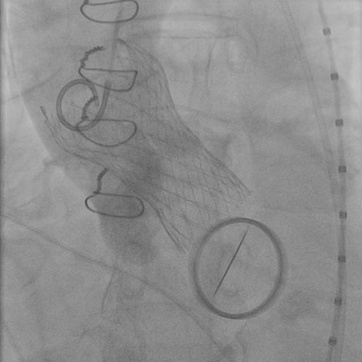 tavr 2