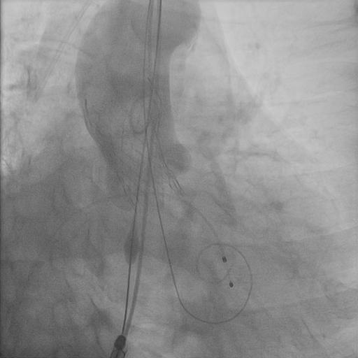 tavr