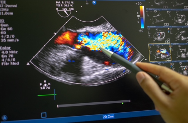 Echocardiogram-standard.jpeg