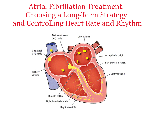 Afib-treatment.jpg