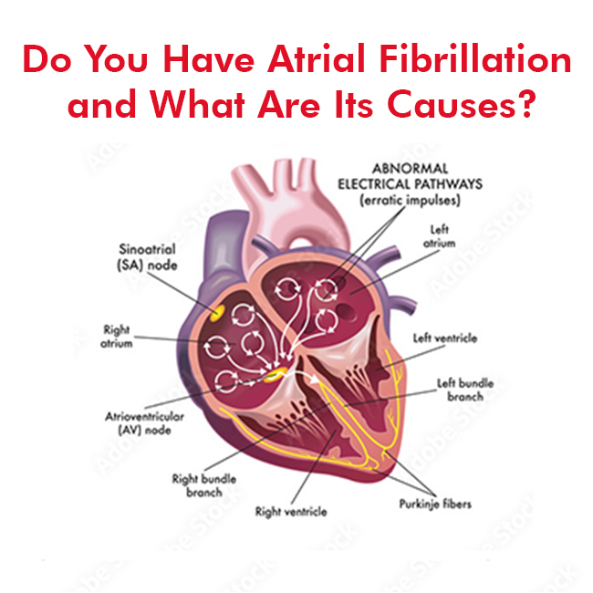 atrial-fibrilliation.jpg