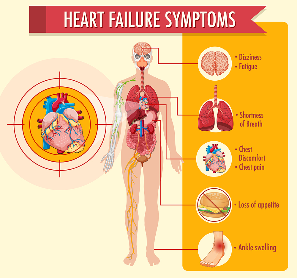 symptom-heart-faliure.jpg