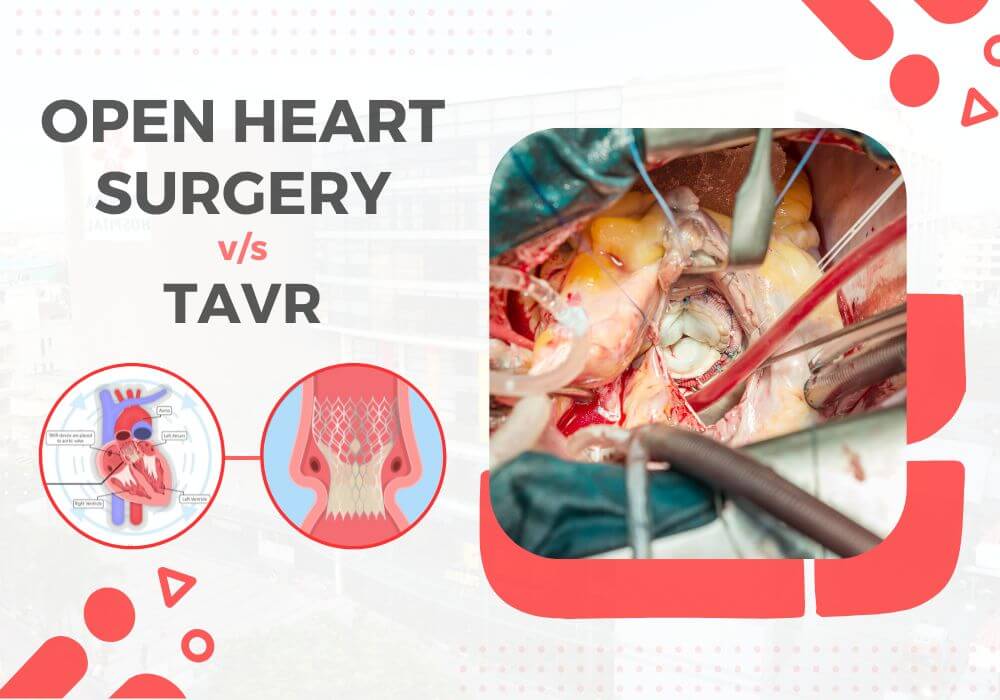 Open-Heart-Surgery-vs.-TAVR-1.jpg